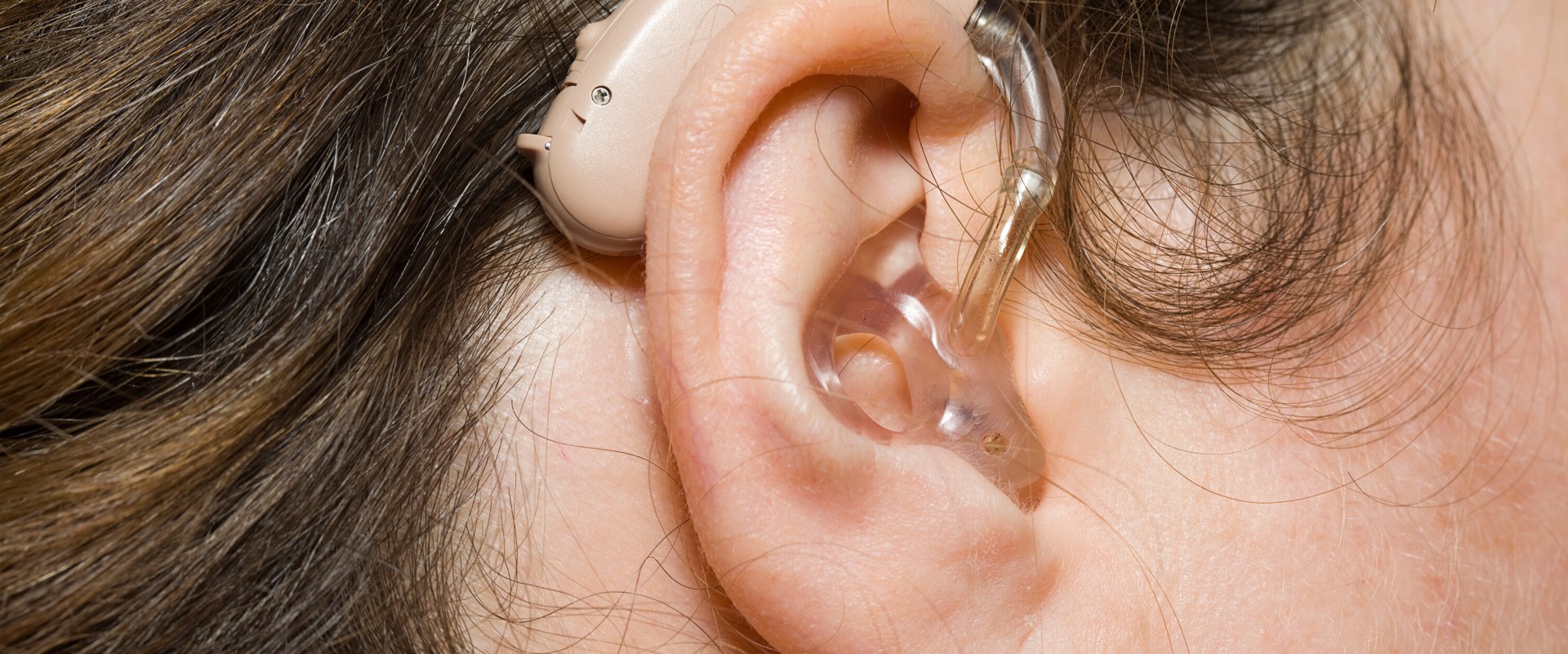 Is there a big markup on hearing aids?