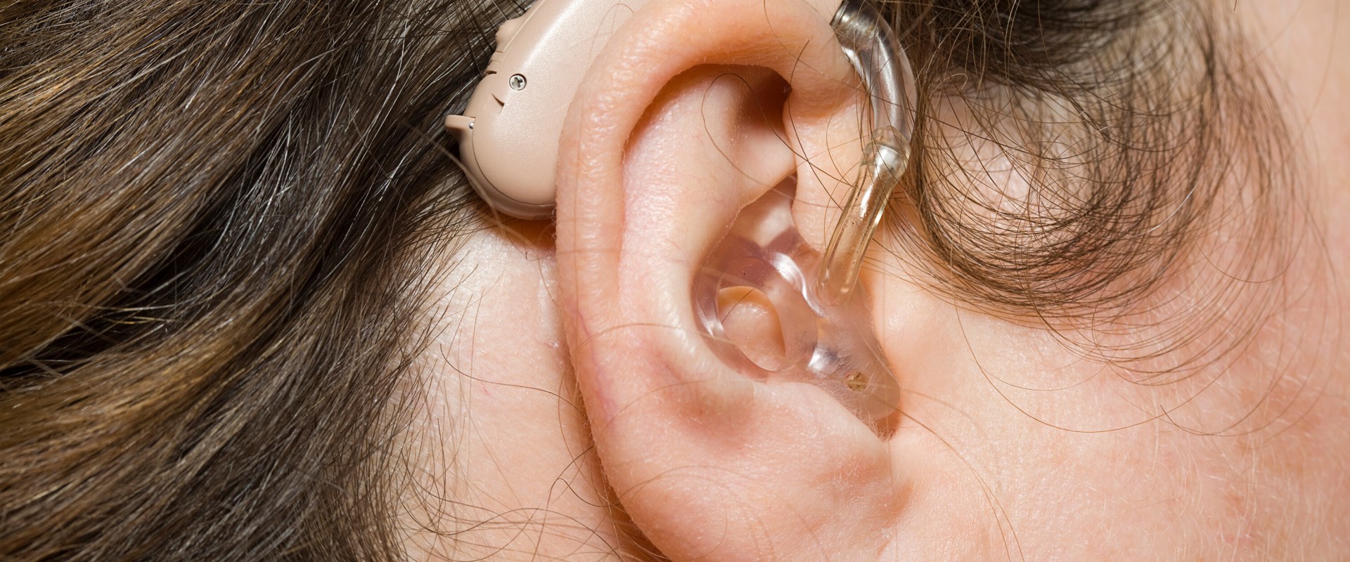 Do you need a prescription to get hearing aids?
