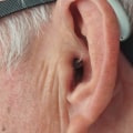 Can all hearing loss be helped with hearing aids?