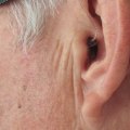 Which hearing aids does the va provide?