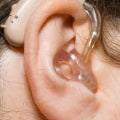 Do you need a prescription to get hearing aids?
