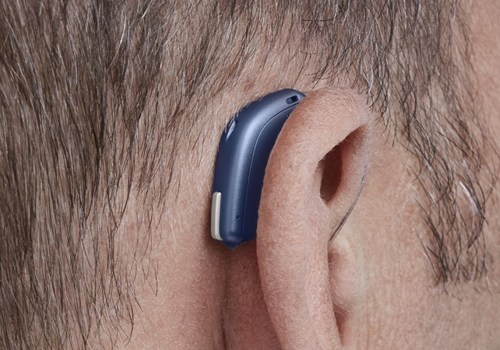 What is the life expectancy of costco hearing aids?