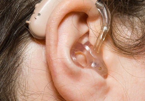 Is there a big markup on hearing aids?