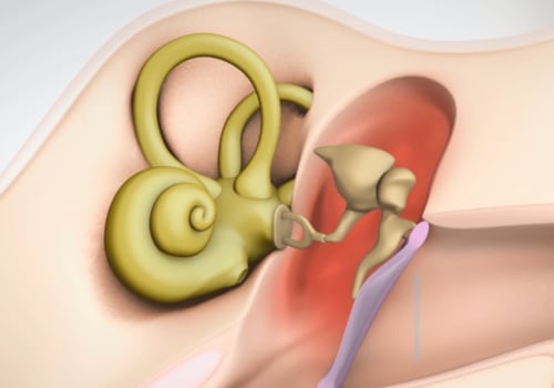 What are the 4 types of hearing?